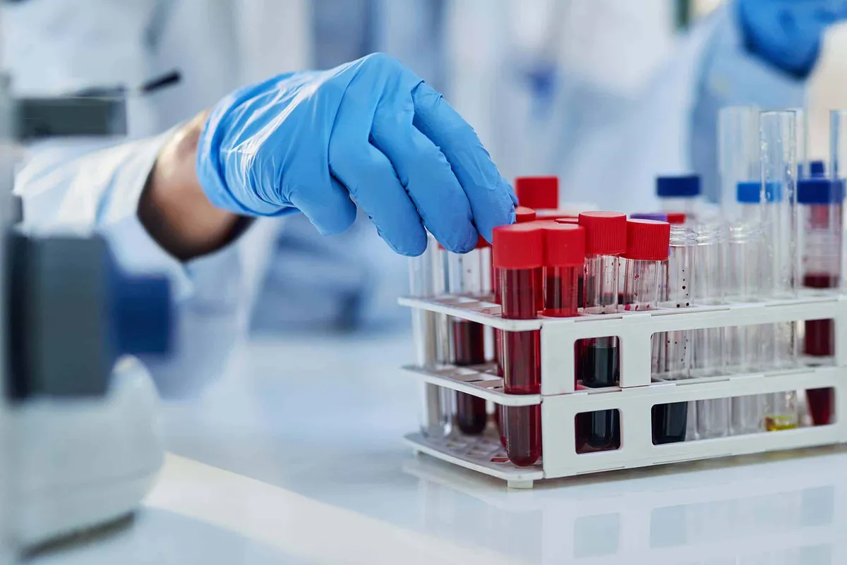 Gloved hand picking a blood sample tube from a rack of test tubes in a lab